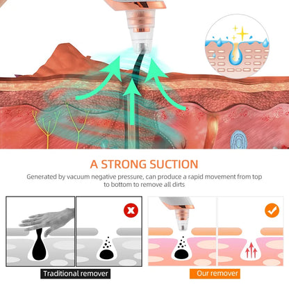 Electric Pore Remover
