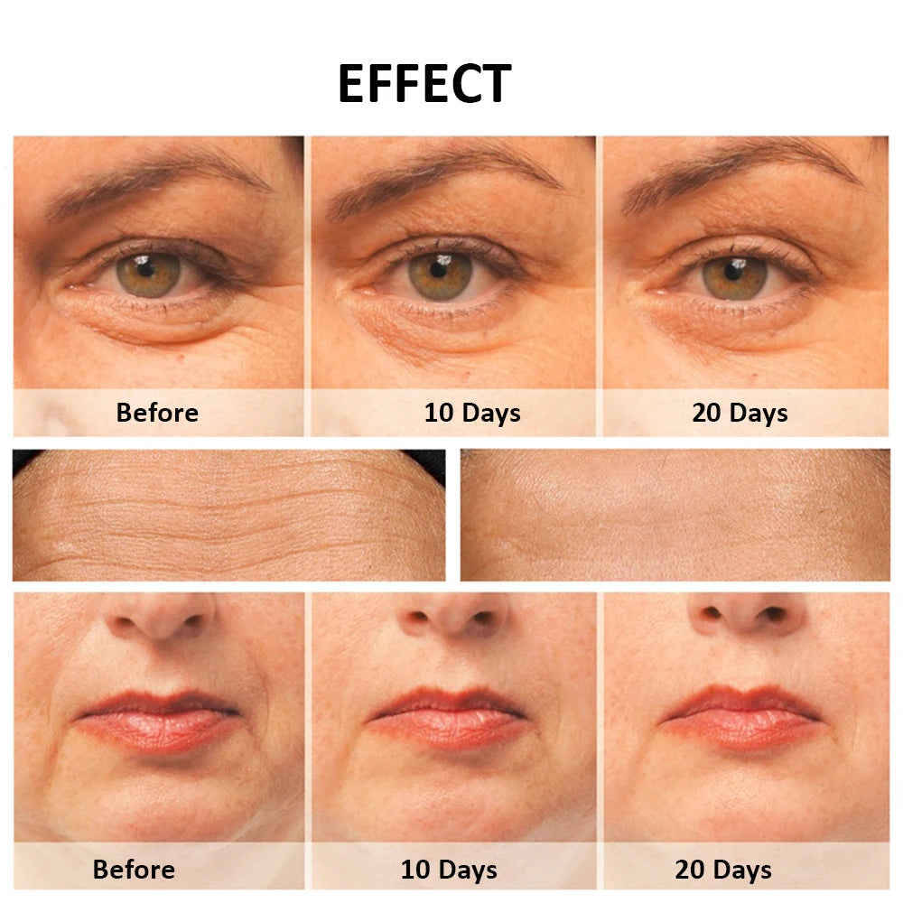 EMS Microcurrent Face Lifting & Anti-Ageing Facial Massager